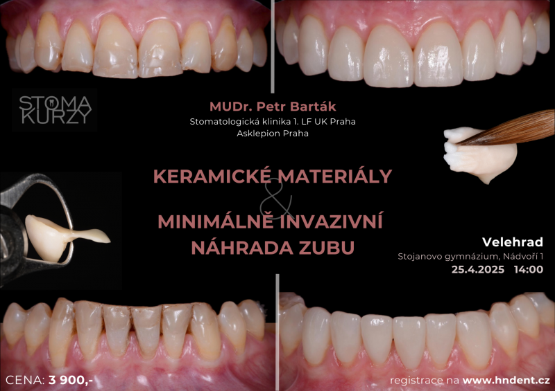 Keramické materiály & minimálně invazivní náhrada zubu