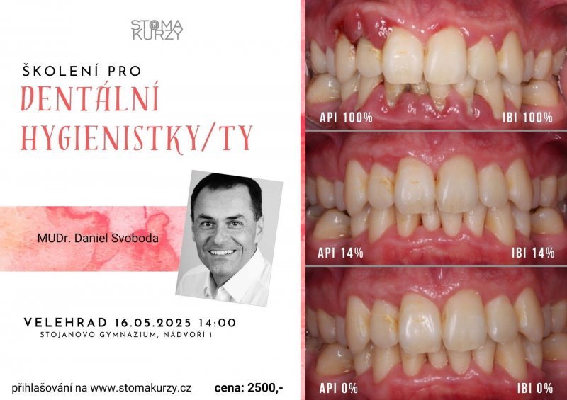 Školení pro dentální hygienistky/ty